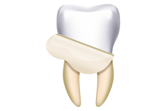 Download Tooth Whitening. Dental Hygiene Cleaning - White Collection